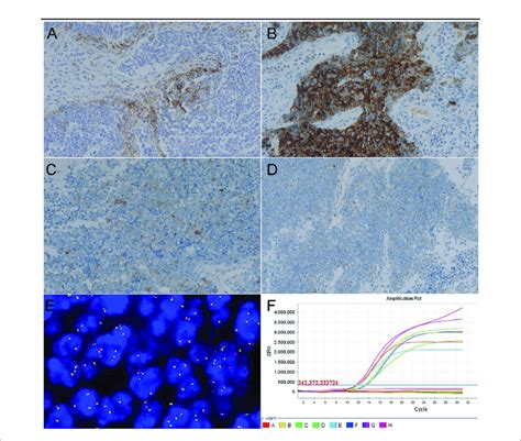 Representative Images Of Targeted Therapy Markers In Cervical Scnc