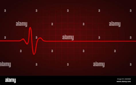 Heartbeat Monitor Dead