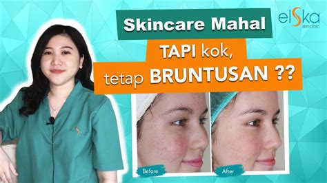 SKINCARE MAHAL Tapi Kok Tetap BRUNTUSAN YouTube