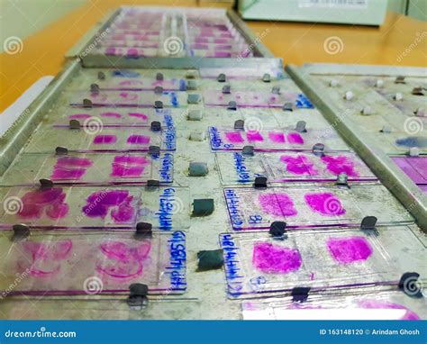 Histopathology Slides Stained with Leishman Stain, Displayed and Ready ...