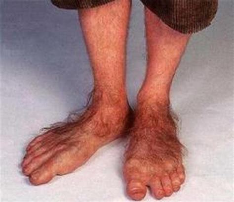 Photos Hilarantes Des Pieds Les Plus Effrayants Et Les Plus Bizarres