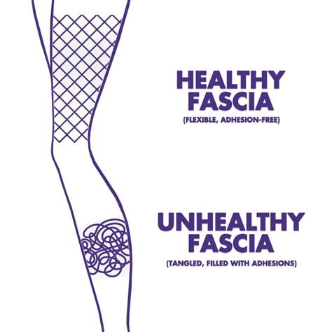 Fascia 101: What Is Fascia Stretching and Why It Matters