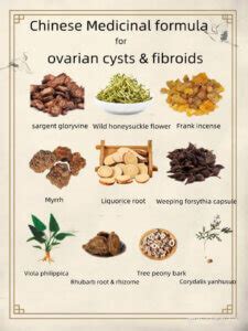 Shrinking Ovarian Cysts Fibroids Naturally Acupuncture Herbs