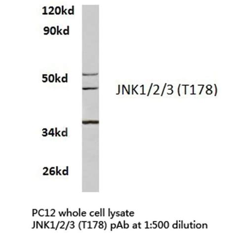 JNK1 JNK2 JNK3 Polyclonal Antibody Invitrogen 100 μL Unconjugated