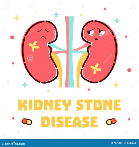 Kidney Stone Formation Stock Photography | CartoonDealer.com #25228634