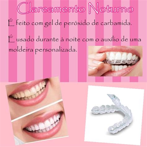 TUDO SOBRE CLAREAMENTO DENTAL NOTURNO 15 RESPOSTAS DEFINITIVAS