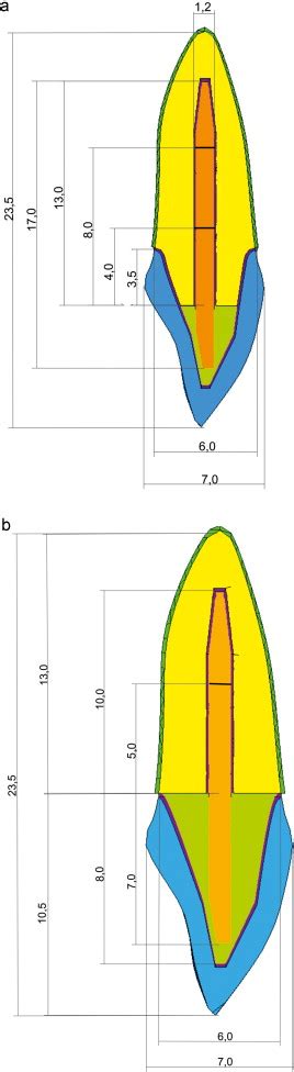 The Influence Of Ferrule Effect And Length Of Cast And Frc Posts On The