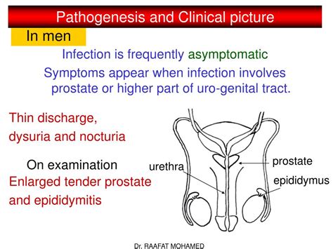 Ppt Trichomonas Vaginalis Powerpoint Presentation Free Download Id3013018