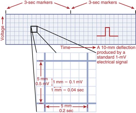 Ecg Waveforms And Intervals Flashcards Quizlet