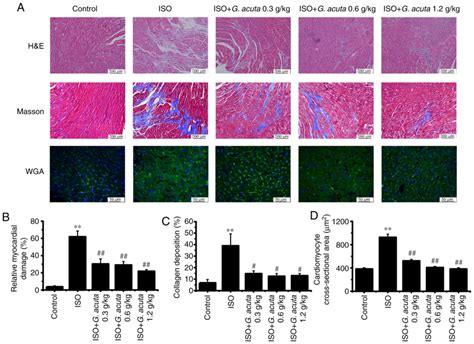 The Aqueous Extract Of Gentianella Acuta Improves Isoproterenolinduced