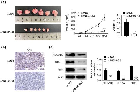 Necab3 Promotes The Migration And Invasion Of Liver Cancer Cells