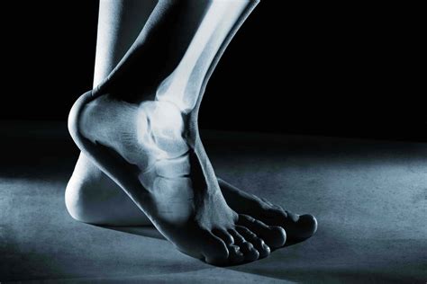 Foot Ankle Surgery Dallas Fort Worth Foot Ankle Specialist