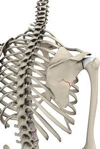 Scapula Fracture Melbourne, VIC | ORIF Surgery Melbourne, VIC