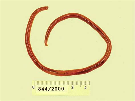 Ascaris lumbricoides - Microbiology Laboratory Turkey