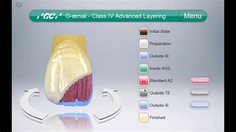 Gc Composite Restorative Guide Youtube