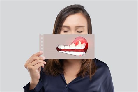 C Mo Prevenir La Gingivitis Y La Periodontitis Gu A Pr Ctica Para Una