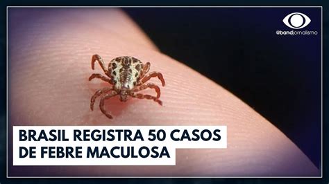 Febre Maculosa Em Campinas Foco De Carrapato Jornal Da Band YouTube