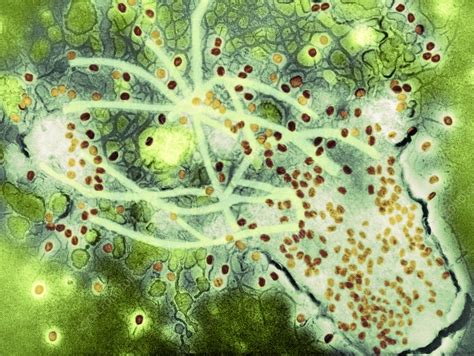 Bacterial lysis due to T4 phage infection, TEM - Stock Image - C052 ...