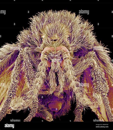 Moth Fly Coloured Scanning Electron Micrograph Sem Of A Moth Fly