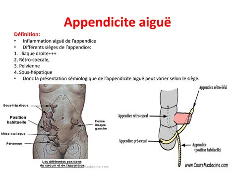 Solution Principaux Syndromes Digestifs Principales Urgences