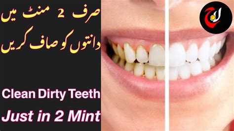 How To Clean Dirty Teeth In Minute At Home Very Fast Way To Clean