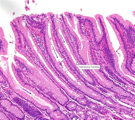 Tejido Epitelial Glandular Laboratorio De Biolog A Interactiva