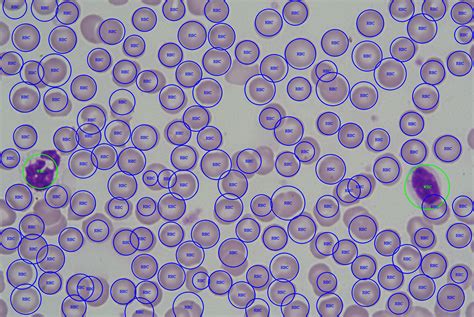 Automatic Identification And Counting Of Blood Cells