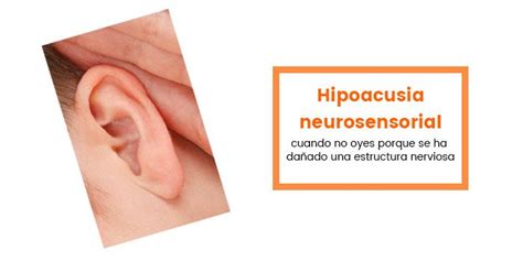 Qué Es Hipoacusia Neurosensorial Y Cuáles Son Sus Causas