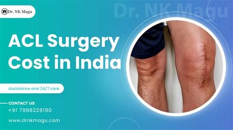 ACL Surgery Cost in India | Get Price Estimate | Dr. NK Magu