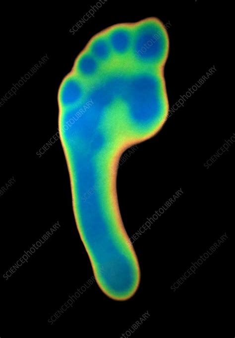 Foot Thermogram Stock Image C015 0461 Science Photo Library