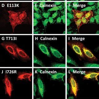 Comparison Of The Intracellular Localization Of DDR2 Wild Type And