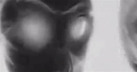 Real Alien Autopsy Photos Roswell Image Of Extra Terrestrial Body