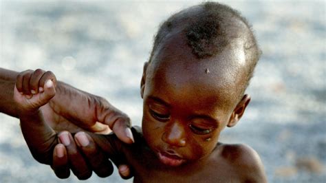 UN: Number of Hungry Children in Africa's Sahel Hits 10-year High