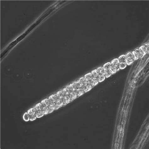 2 Zoosporangium (containing numerous zoospores) of a water mold | Download Scientific Diagram