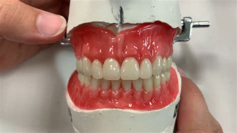 How To Make The Most Effective Denture Wax Try In For The Best Results