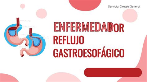 Enfermedad Por Reflujo Gastroesof Gico Elizabeth Hern Ndez Udocz