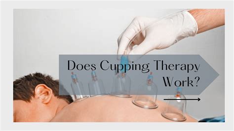 Does Cupping Therapy Work? - Cup Cure