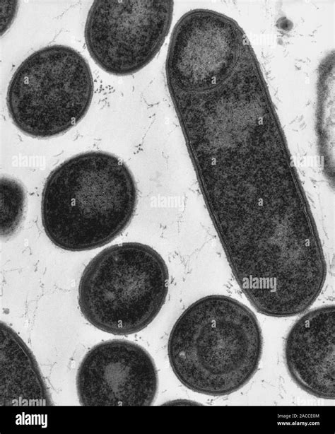 Micrografía De Electrones De La Transmisión De La Bacteria Clostridium