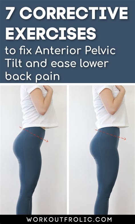 7 Anterior Pelvic Tilt Exercises To Fix Painful Lower Back