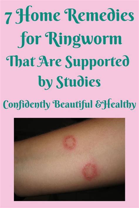 7 Home Remedies for Ringworm That Are Supported by Studies | Home ...