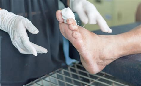 Diabetic Foot Care Sydney | Podiatrist in Sydney