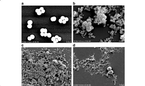 Scanning Electron Microscopy Sem Photograph Of Mrsa Treated With