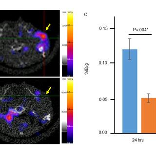 Static Granzyme B PET Imaging With 68 Ga GZP One Hour After