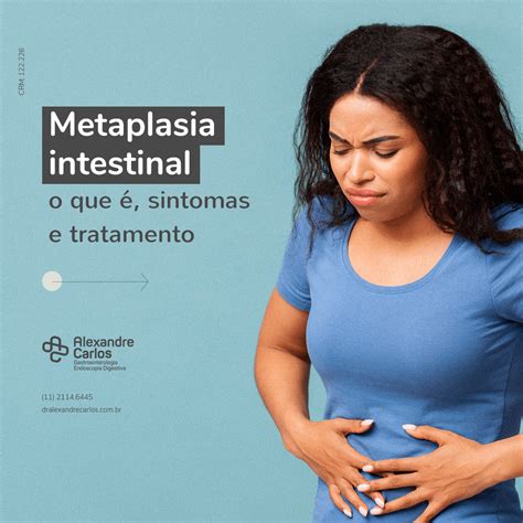 Metaplasia Intestinal Dr Alexandre Carlos