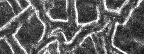 Biofilm Examples