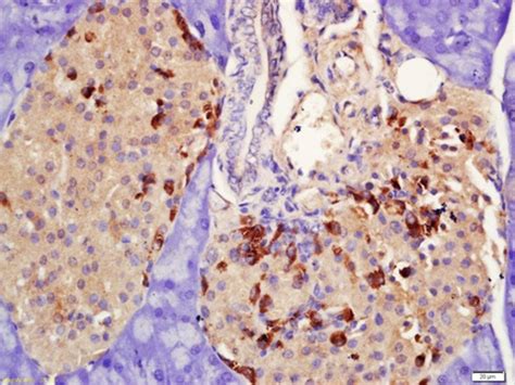 Anti Prolactin Receptor PRL R Antibody Ab214303 Abcam