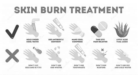 First Aid for Burns Infographic – SafetyNow ILT