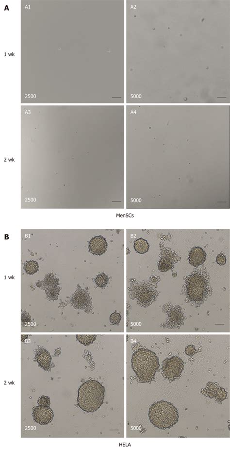 Tumorigenicity Analyses Of Menstrual Derived Stromal Stem Cells And Download Scientific Diagram