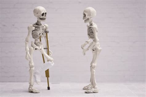 924件の「broken Bones Funny」の画像、写真素材、3dオブジェクト、ベクター画像 Shutterstock