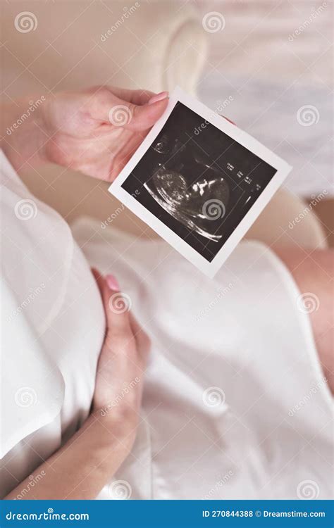 Ultrasound Scan Of Pregnancy Expecting A Baby Stock Photo Image Of